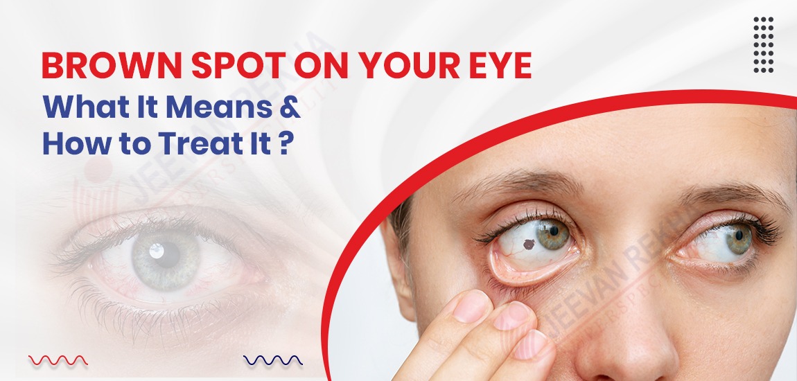 Brown Spot On Your Eye What It Means And How To Treat It