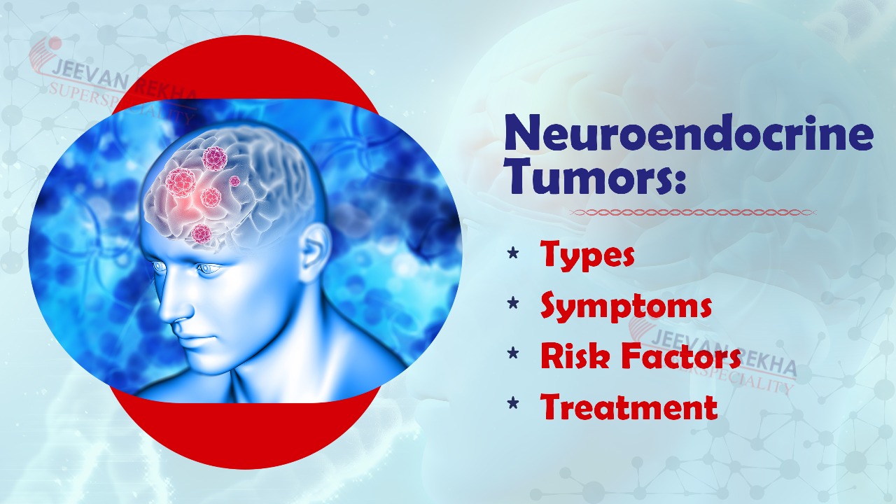 Neuroendocrine Tumors: Types, Symptoms, Risk Factors & Treatment