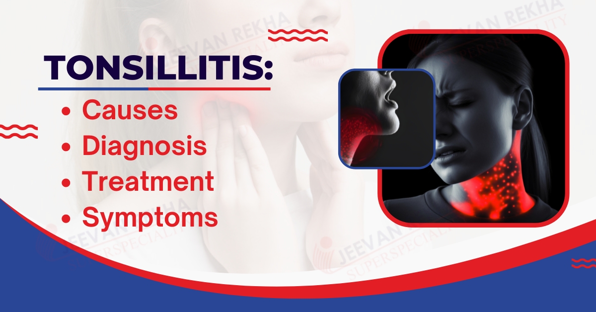 Tonsillitis: Symptoms, Causes, Treatment & Diagnosis