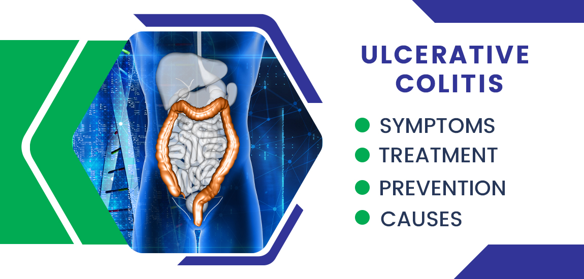 Ulcerative Colitis Signs and Symptoms (& Why They Occur), and
